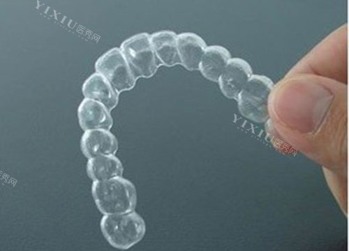 济南平阴县牙齿矫正多少钱？这份价格表从金属矫正到隐形牙套收费都含有！(图3)