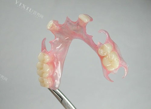 抄作文喽！北京牙冠价格2024来袭，烤瓷牙冠880+全瓷牙冠国产1200+进口2000+(图2)