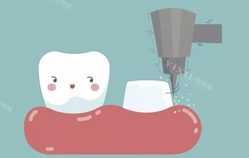 楚雄种植牙哪家医院好？排名榜单中奥德、爱牙、伍鹏口腔有技术又便宜(图2)