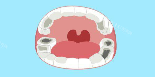 楚雄种植牙哪家医院好？排名榜单中奥德、爱牙、伍鹏口腔有技术又便宜(图1)