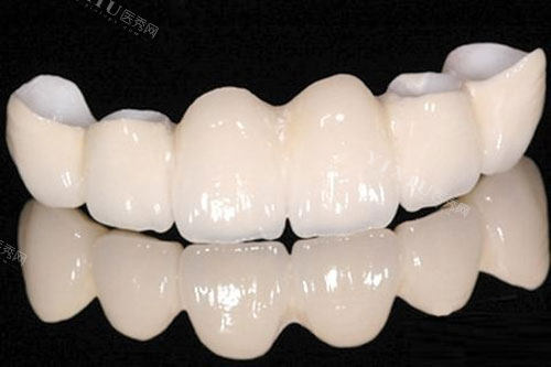 不看后悔！北京牙冠修复价格都不贵，含启康、齿康达、仁爱、倪氏、顺德口腔(图2)