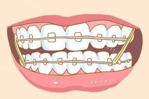南京蓝鲟口腔正畸5个优势：出色专科团队只是其中之一！(图3)