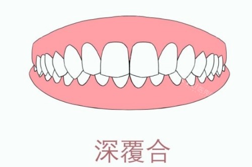 南京蓝鲟口腔正畸5个优势：出色专科团队只是其中之一！(图2)