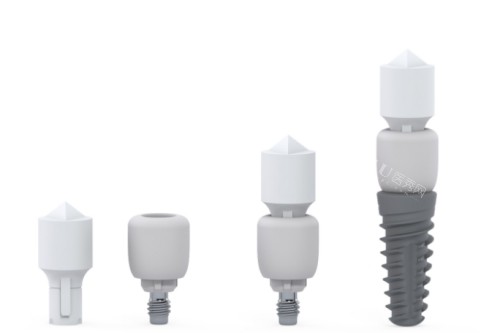 康贝佳口腔医院价格表更新：大家关注的种牙到洁牙项目都在这里！(图1)