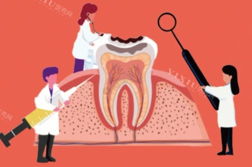 康贝佳口腔医院价格表更新：大家关注的种牙到洁牙项目都在这里！(图3)