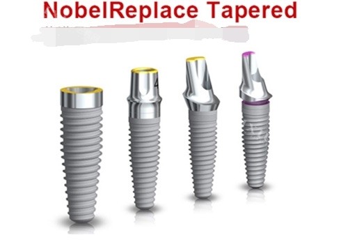 不再为价格犯愁！银川金凤区种植牙价格大盘点，让医生告诉你种牙究竟多少钱！(图2)