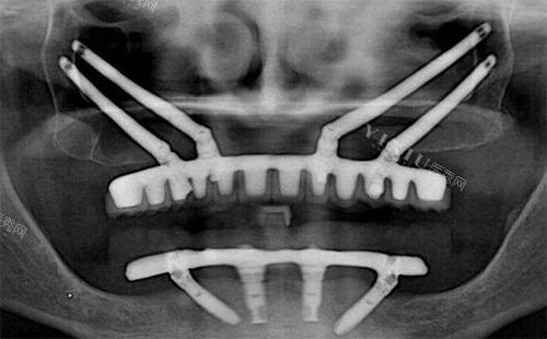 济南商河县口腔诊所哪个好？看牙好的有德良口腔、京来口腔、已诺口腔等~(图4)