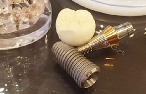 瑞士士卓曼种植体型号详解，带你了解种植体亲水和非亲水区别！(图2)