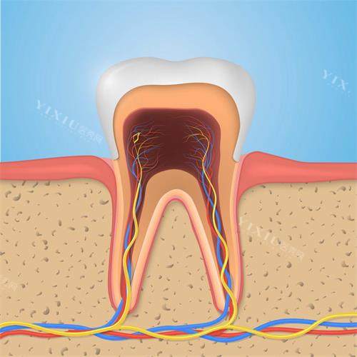 不懂就问:牙神经是用针取出来吗?一次性能取完吗?
