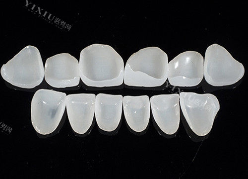 牙齿贴面玻璃陶瓷材料