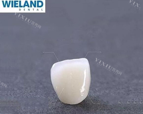 牙冠修复材料展示照片图