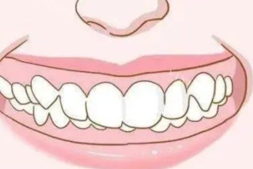 牙齿龅牙卡通图