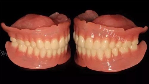 全口吸附性义齿模型展示图