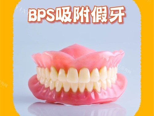 BPS吸附性义齿模型图
