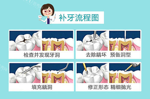 补牙流程图示