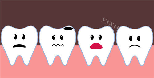 牙齿龋坏卡通示意图