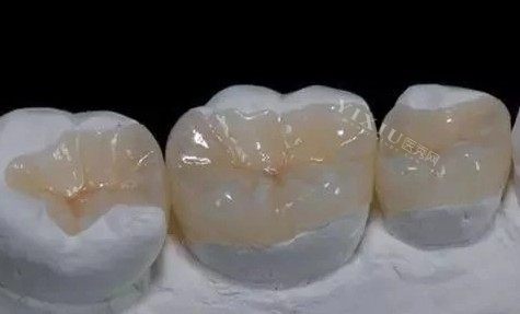 补牙牙模