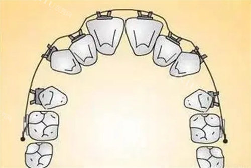 牙齿畸形展示图