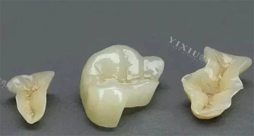 牙齿修复材料图