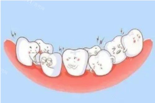 牙齿畸形卡通图