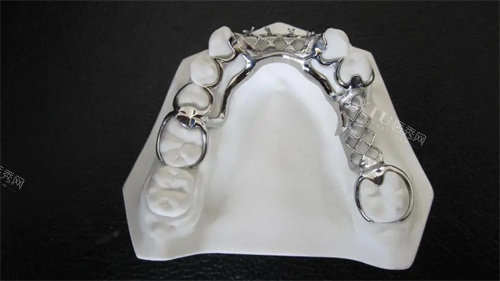 维他灵活动牙什么材质？假牙材质优缺点一定要悉知！(图2)