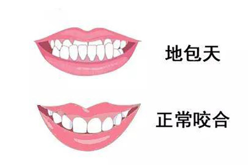 曲靖牙齿矫正大概要花费多少钱？8000-50000元起不等！具体请查询正畸牙套价格表(图2)