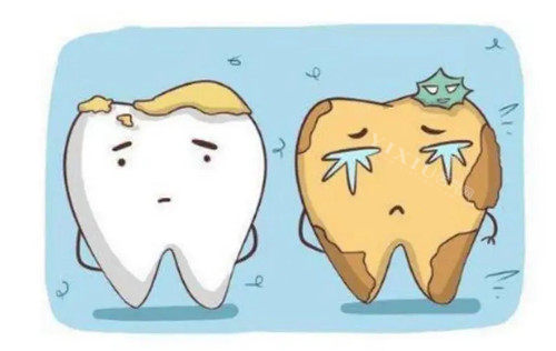 需要清洁的牙齿卡通示意图
