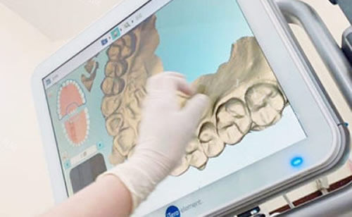 欧欧球托是国产还是进口，做牙齿矫正技术特点有哪些正畸收费贵不贵？(图1)