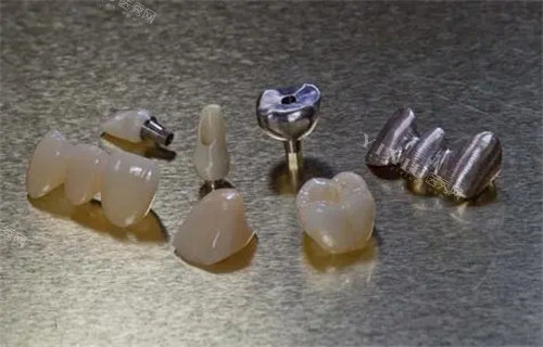 韩国奥齿泰种植牙有几个系列？U系列／SS系列／TS系列／MS系列多方面分析！(图2)