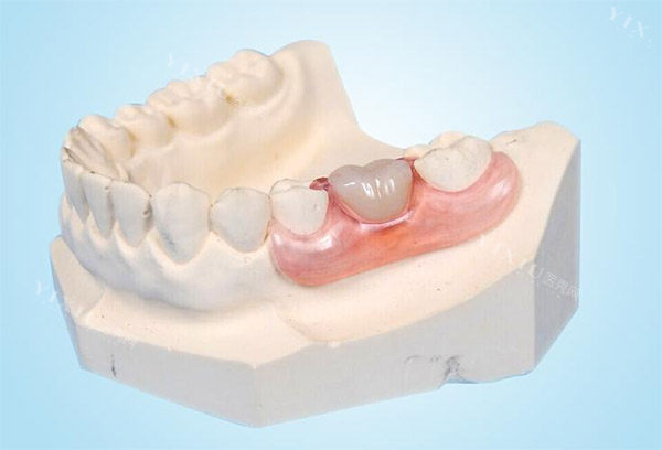 巴彦淖尔镶牙好的医院排名公布：均是巴彦淖尔镶牙技术好的医院！(图1)