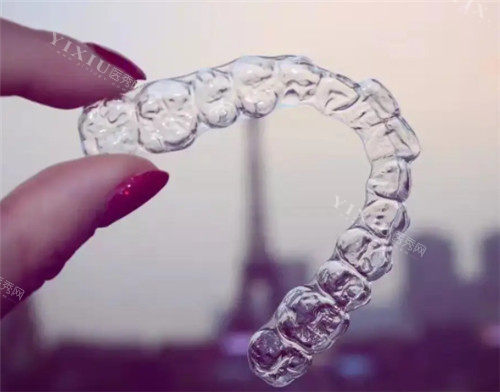 曙美隐形牙套好不好？用过的人都说好！质量好，价格4000~12800元起，矫正成效佳(图2)