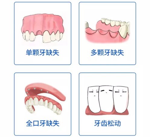 单颗多颗全口牙齿缺失及牙齿松动漫画图