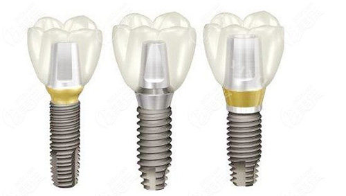 韩国多普勒植体是低端产品吗？真不是！从材质／价格／使用时间等方面详细介绍！(图1)