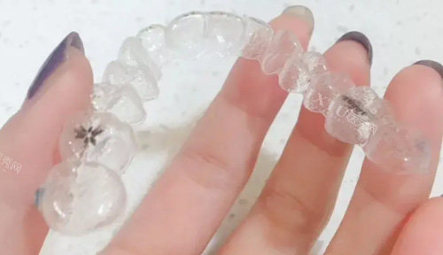 时代天使隐形牙套官网矫正价格公开，三个版本正畸收费差异大千万别错过！(图1)