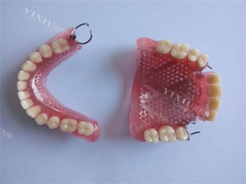 仿生牙和活动假牙有什么区别？仿生牙怎么安装的？一篇文章告诉你所有答案！(图2)