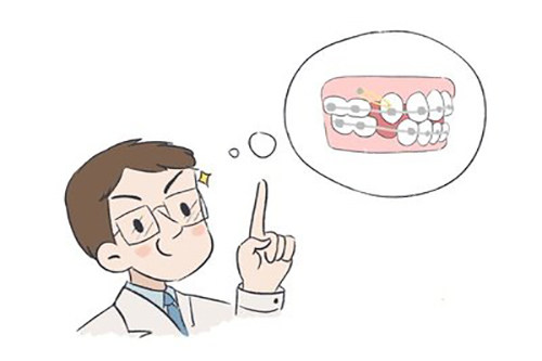 矫牙后为何牙缝无法完全闭合？医师详解可能的原因！(图1)