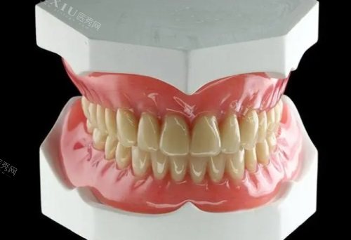 仿生牙和活动假牙有什么区别？仿生牙怎么安装的？一篇文章告诉你所有答案！(图1)