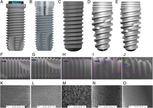 美国3I种植牙于其他植体对比
