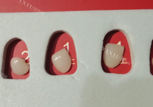 想做牙贴面不知道蓝瓷和琥珀瓷哪个贵，一文看懂牙贴面材料特点和收费明细！(图5)