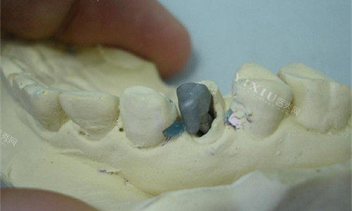 晋州哪家看牙便宜又靠谱？当地人良心介绍这三家项目全口碑好价格还不贵！(图1)