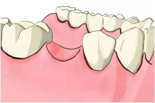 宝鸡岐山做种植牙哪家好？本地人推荐种植选这五家可信赖！(图3)