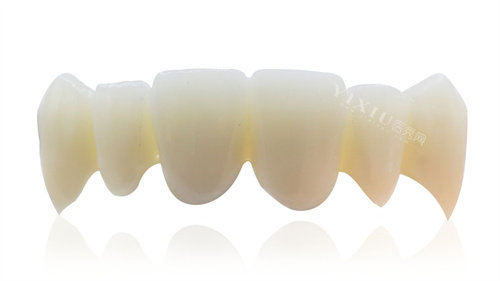 做3M拉瓦全瓷牙费用得好几万？为什么这么贵？价格浮动大不一定是这么多！(图3)