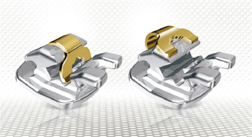 正畸小课题：今天分享的是日本拓美陶瓷自锁托槽优势特点／口碑评价~(图2)