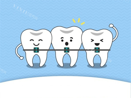 NIC速航牙齿矫正怎么样？带多久能看到成效？(图1)