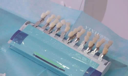 杭州桐庐种植牙好口腔排名分享，启典／尚雅／众乐口腔技术好千万别错过！(图3)