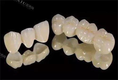 昆明做牙冠多少钱一颗？2024昆明牙冠价格表一览，全瓷牙、烤瓷牙价格清晰(图2)