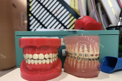 南宁康齿乐口腔看牙收费价格表分享，成人正畸6800元起收费合理别错过！(图5)