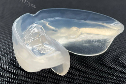 ​宝妈求助！八岁小孩门牙缝隙大怎么办？可能原因与改善方式详解(图3)