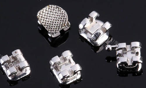 正畸小课堂：上牙扩弓下牙会随之变化吗？点击了解口腔正畸知识解析(图3)