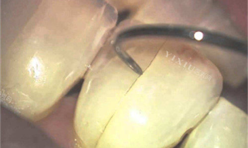 周口爱心口腔怎么样？采访五位当地人真实反馈揭露内部详情！(图2)